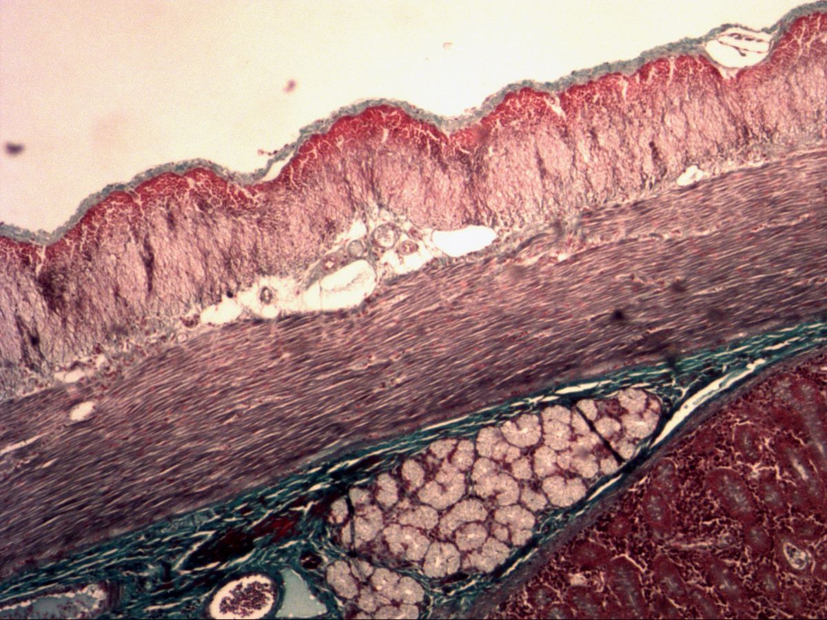 Duodenal wall, trichrome, overview: Brunner glands in the submucosa