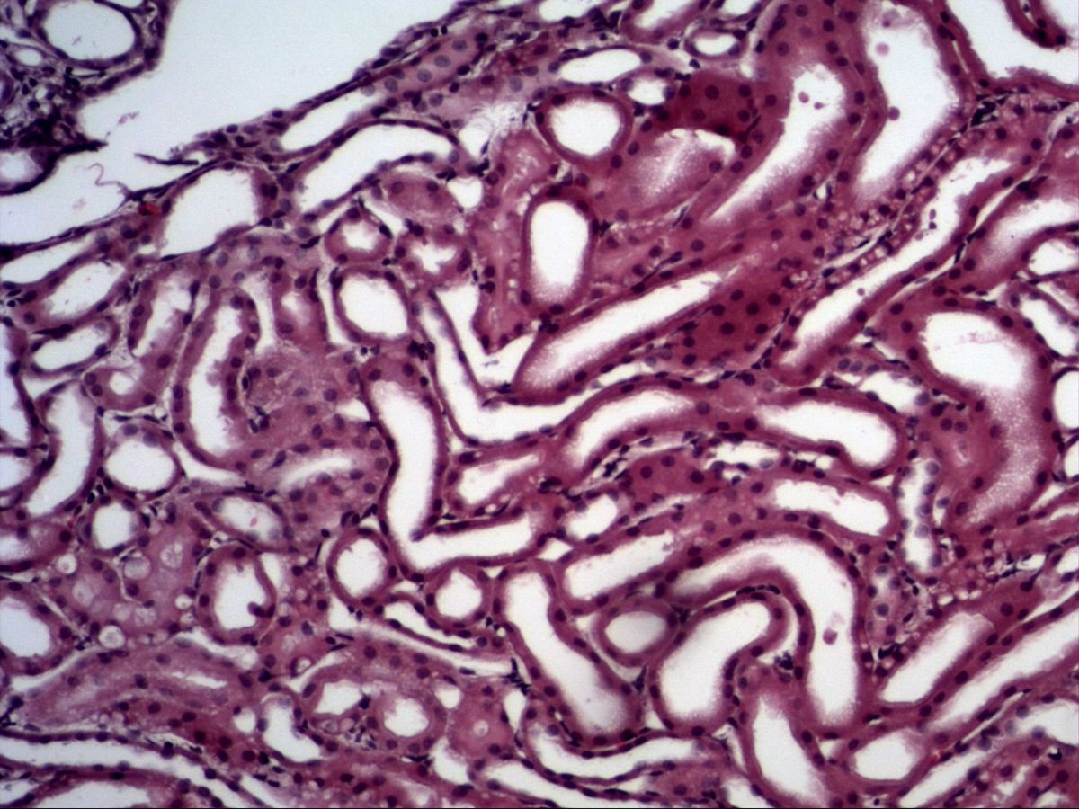 Kidney, H&E, medium magnification: tubules lined by squamous and cuboidal epithelium