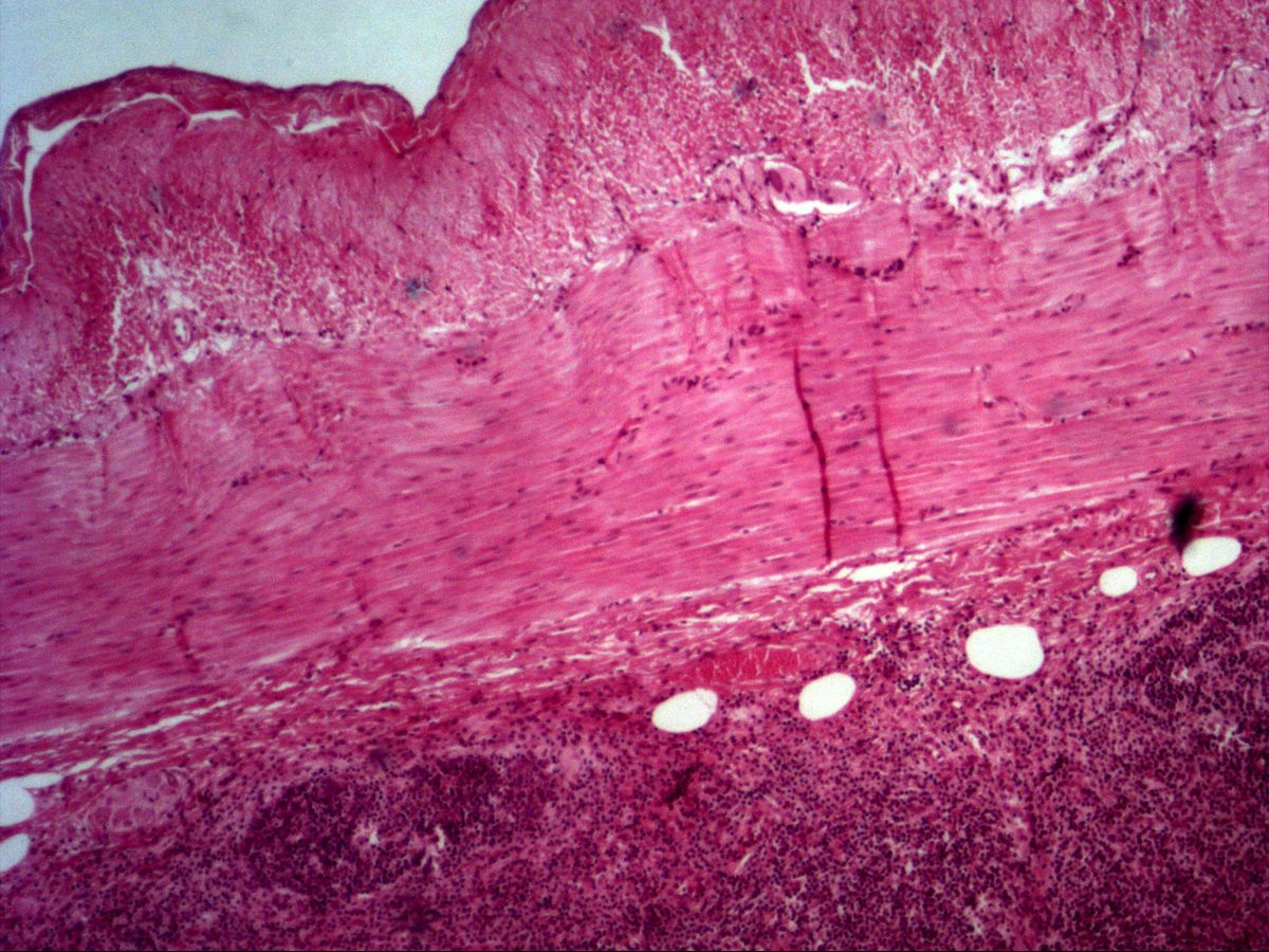 Ileum wall, H&E, overview: two-layered tunica muscularis and lymphoid tissue