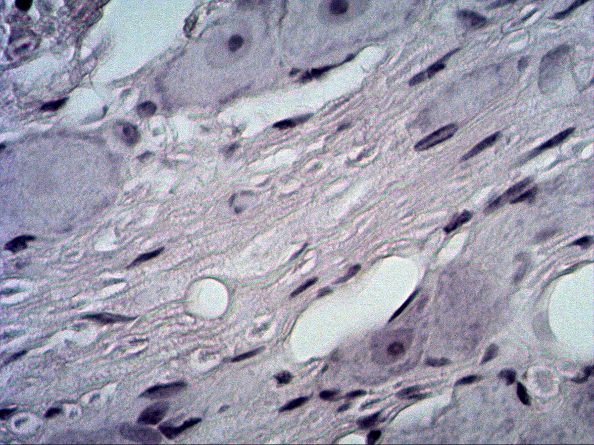 Trigeminal ganglion, H&E, nerve fibres between neurons